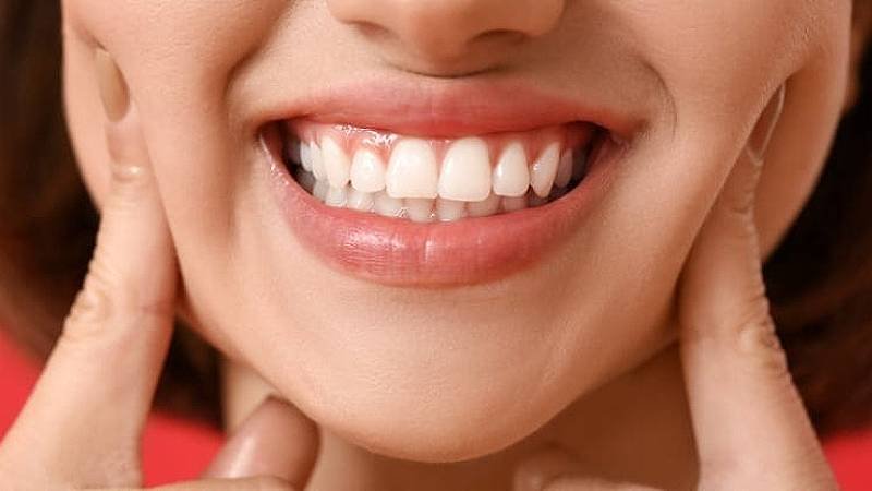 Ang Mo Kio最佳牙医诊所